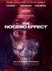 The Nocebo Effect (Nocebo)
